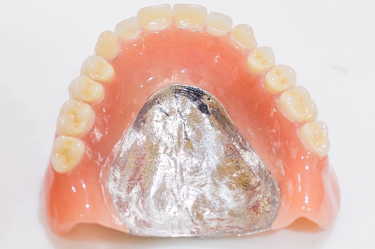 保険適用外の入れ歯