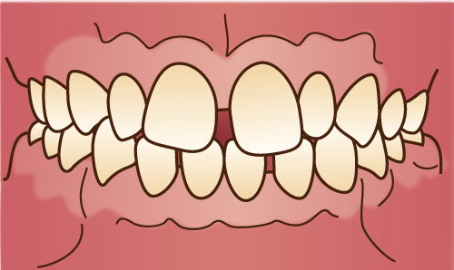 前歯だけ、気になるところだけを治したい方へ