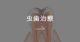 むし歯治療