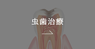 むし歯治療